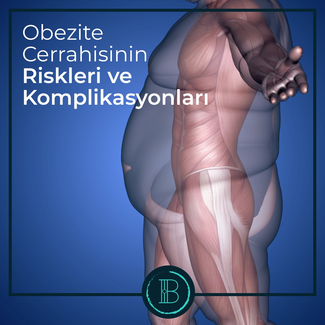 Obezite Cerrahisinin Riskleri ve Komplikasyonları - Prof. Dr. Burak Kavlakoğlu