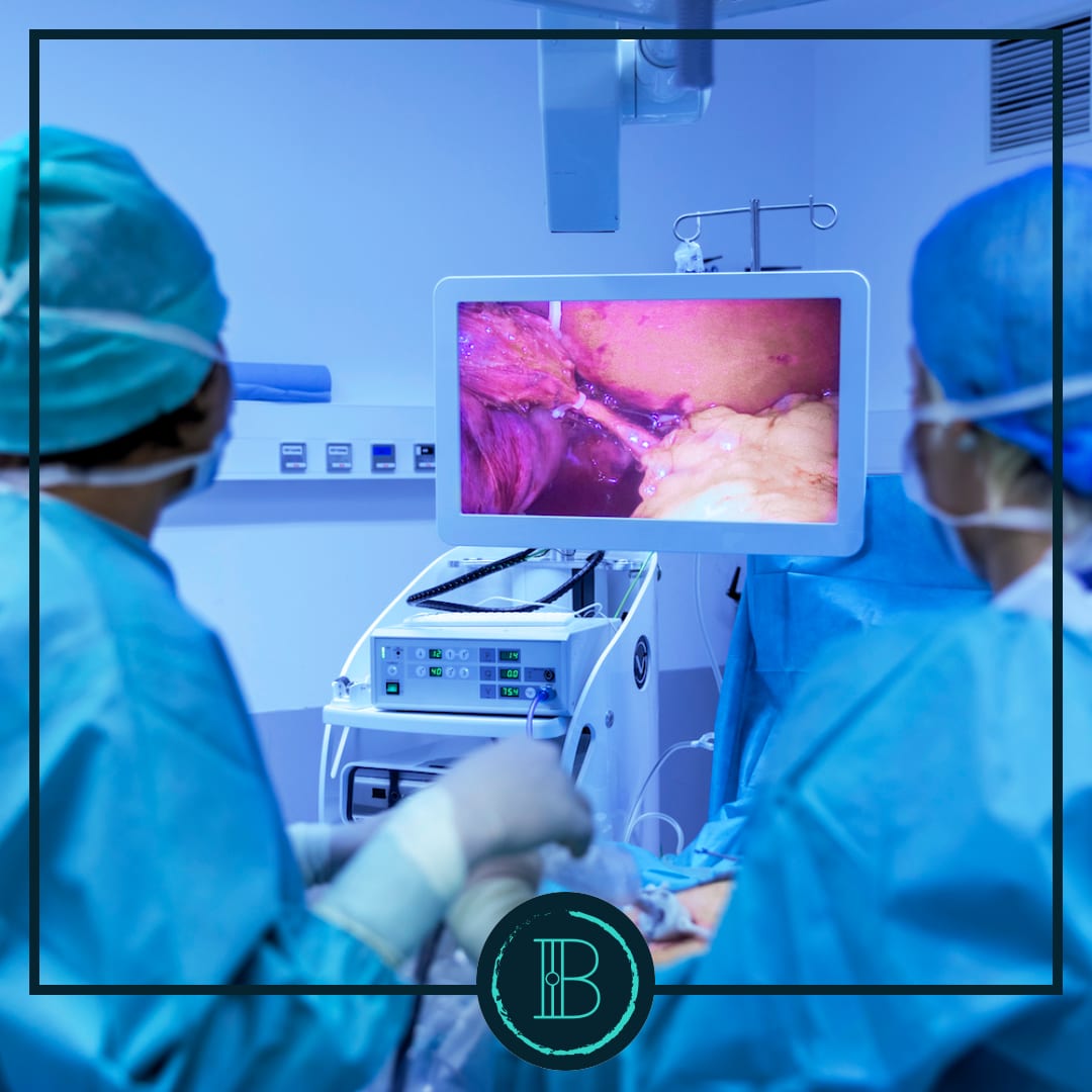 Reoperative Bariatric Surgery